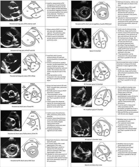 american society of echocardiography charts.